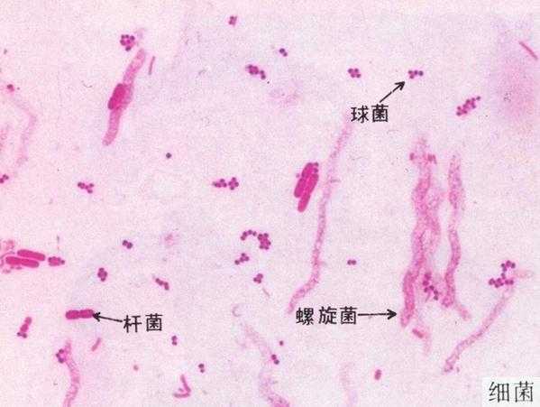 霉菌感染是什么原因引起的